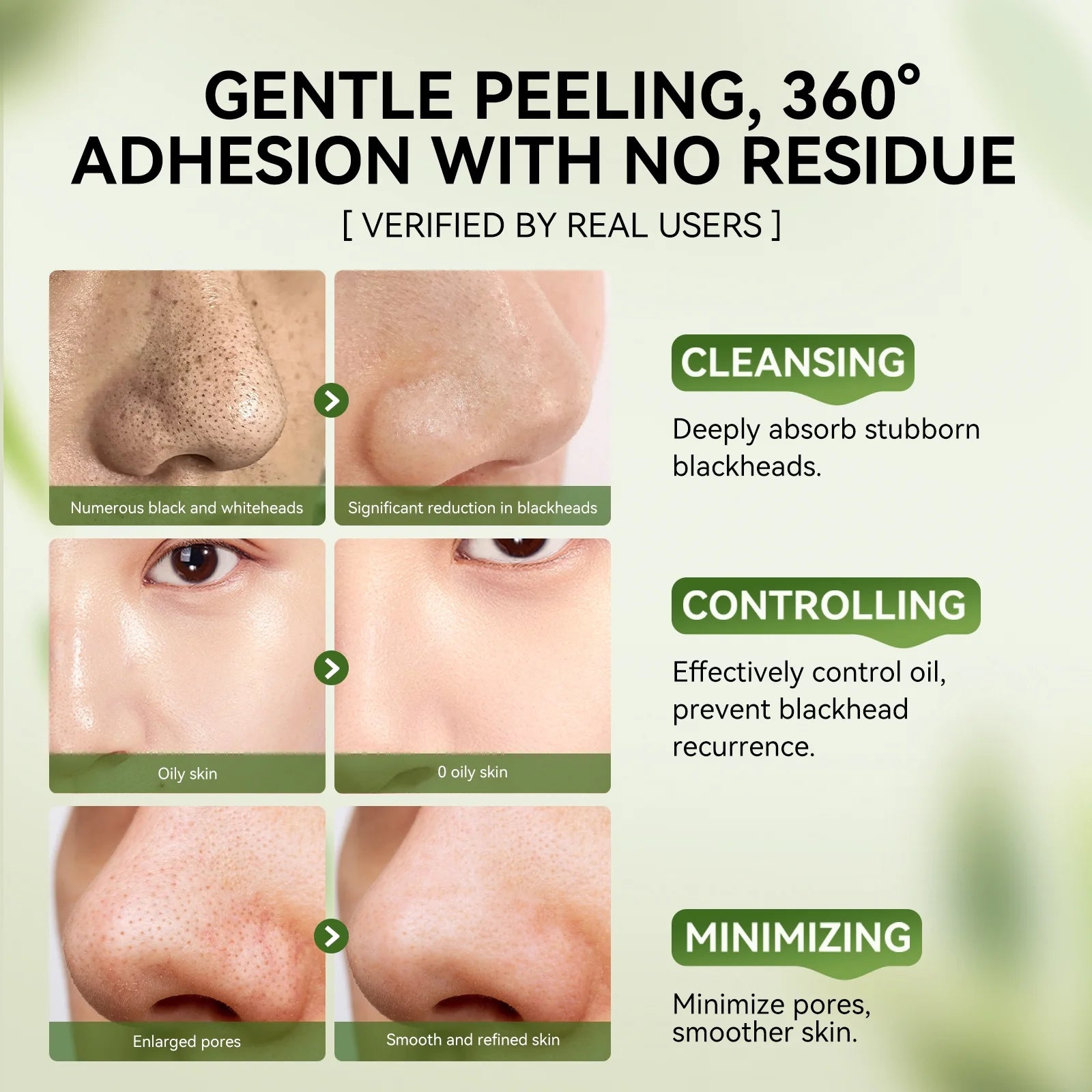 3-In-1 Blackhead Removal Set - Bamboo Charcoal Pore Strips (30G), Pore Minimizing Serum (30Ml) & Removal Paper - Mask for Face, Minimizes Pores & Leaves Skin Fresh & Clean, Blackhead Remover